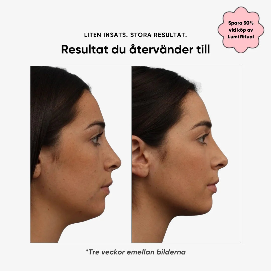 Lumi Lift