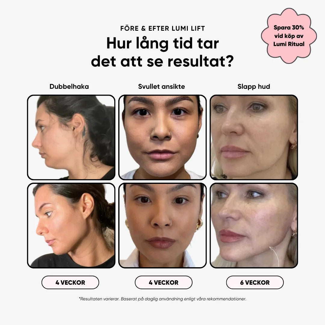 Lumi Lift